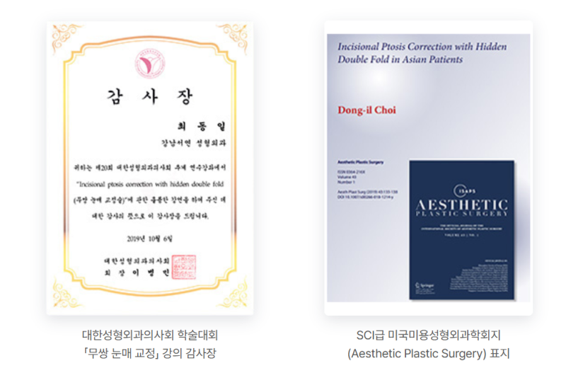 남자 인상을 좌우하는 것은? '쌍꺼풀 없애기' 하는 진짜 이유 사진 11