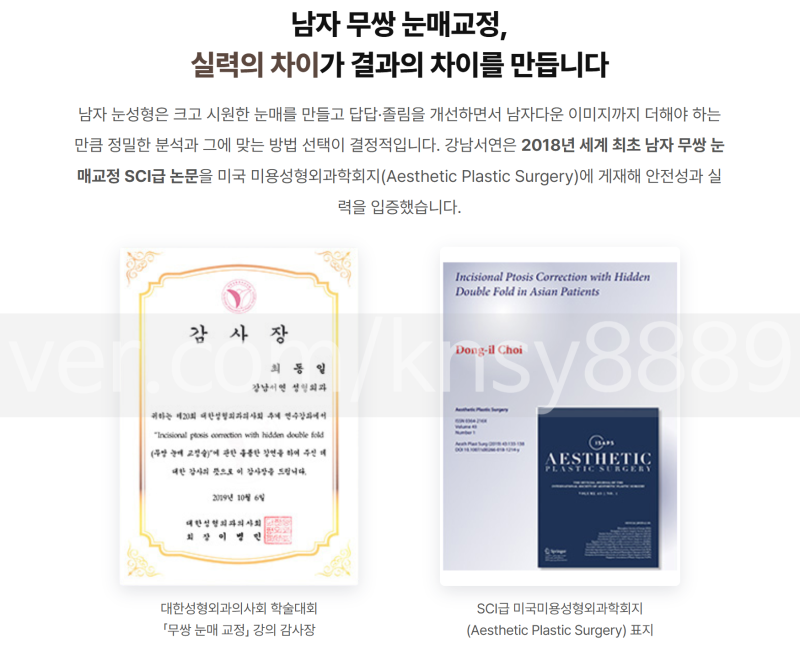 남자 쌍꺼풀 절개, 티 안 나게 자연스럽게 될 수 있을까요? 사진 12