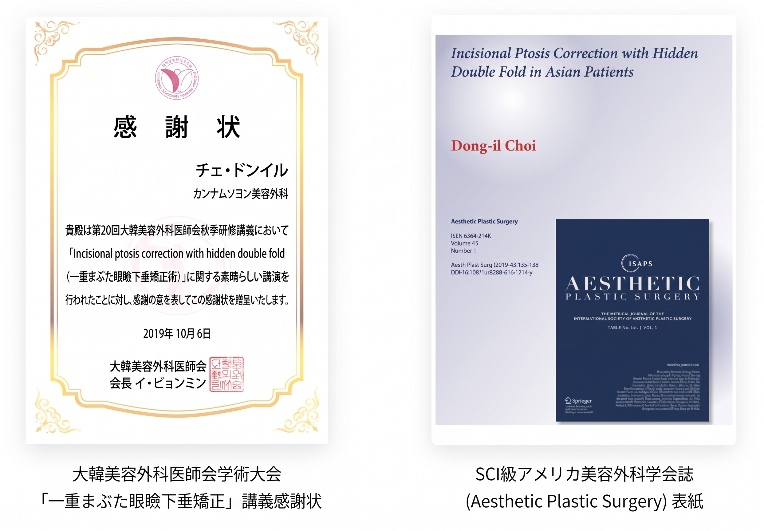 男性の二重幅狭小手術、世界初SCI論文が裏付ける理由 사진 3