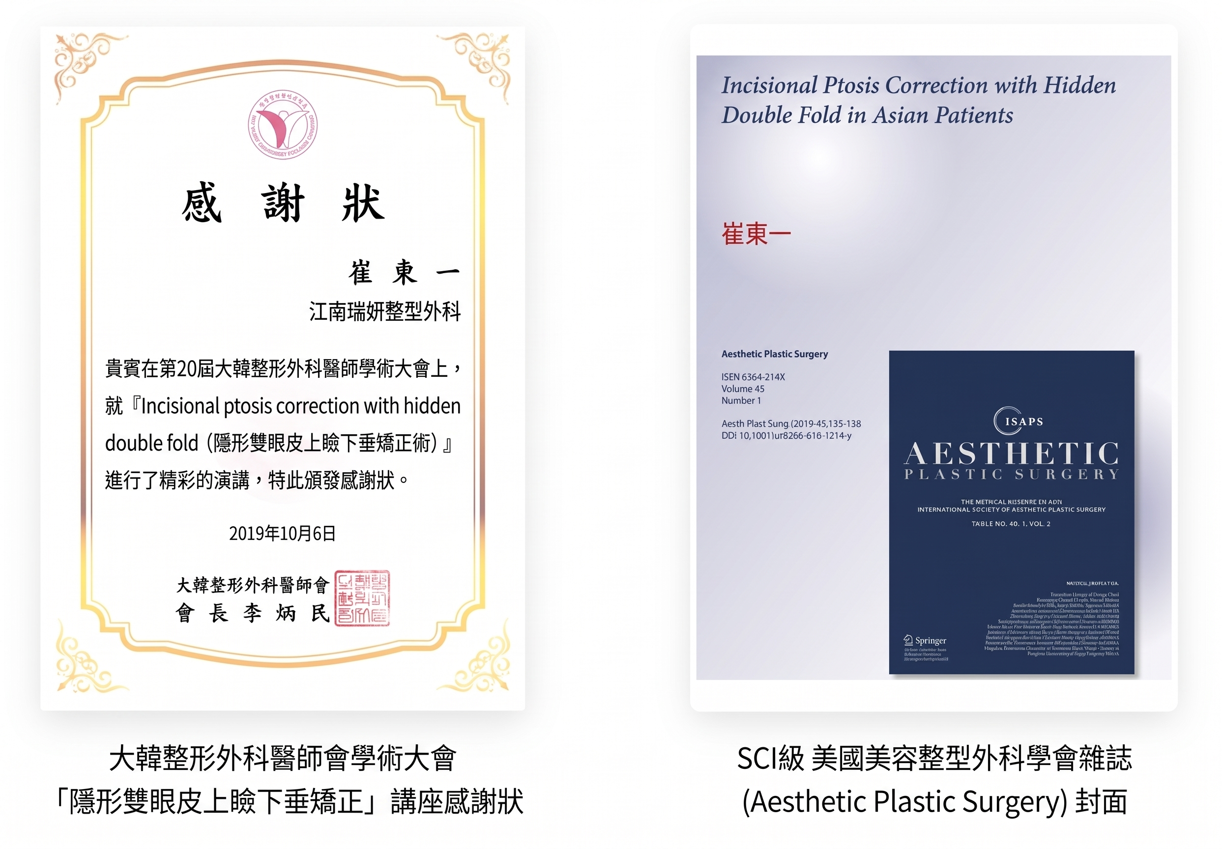 男性雙眼皮降窄手術，由全球首篇SCI國際論文佐證的專業實力 사진 3