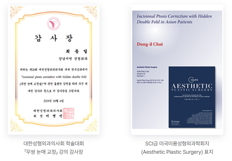 남자 쌍꺼풀 낮추기, 세계 최초 SCI 논문이 뒷받침하는 이유 사진 3