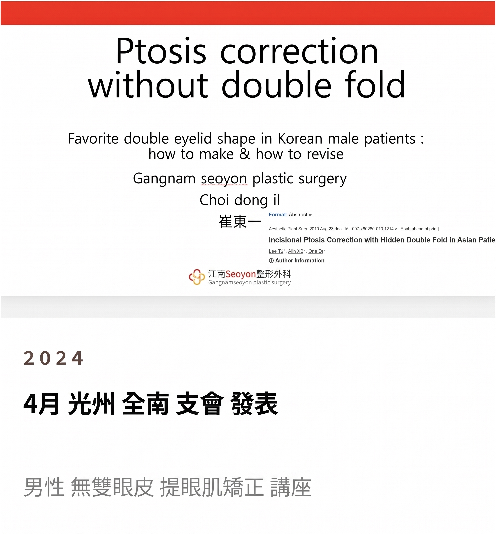 男性雙眼皮降窄手術，由全球首篇SCI國際論文佐證的專業實力 사진 4