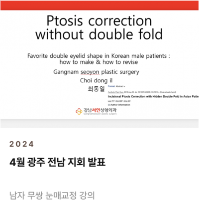 남자 쌍꺼풀 낮추기, 세계 최초 SCI 논문이 뒷받침하는 이유 사진 4