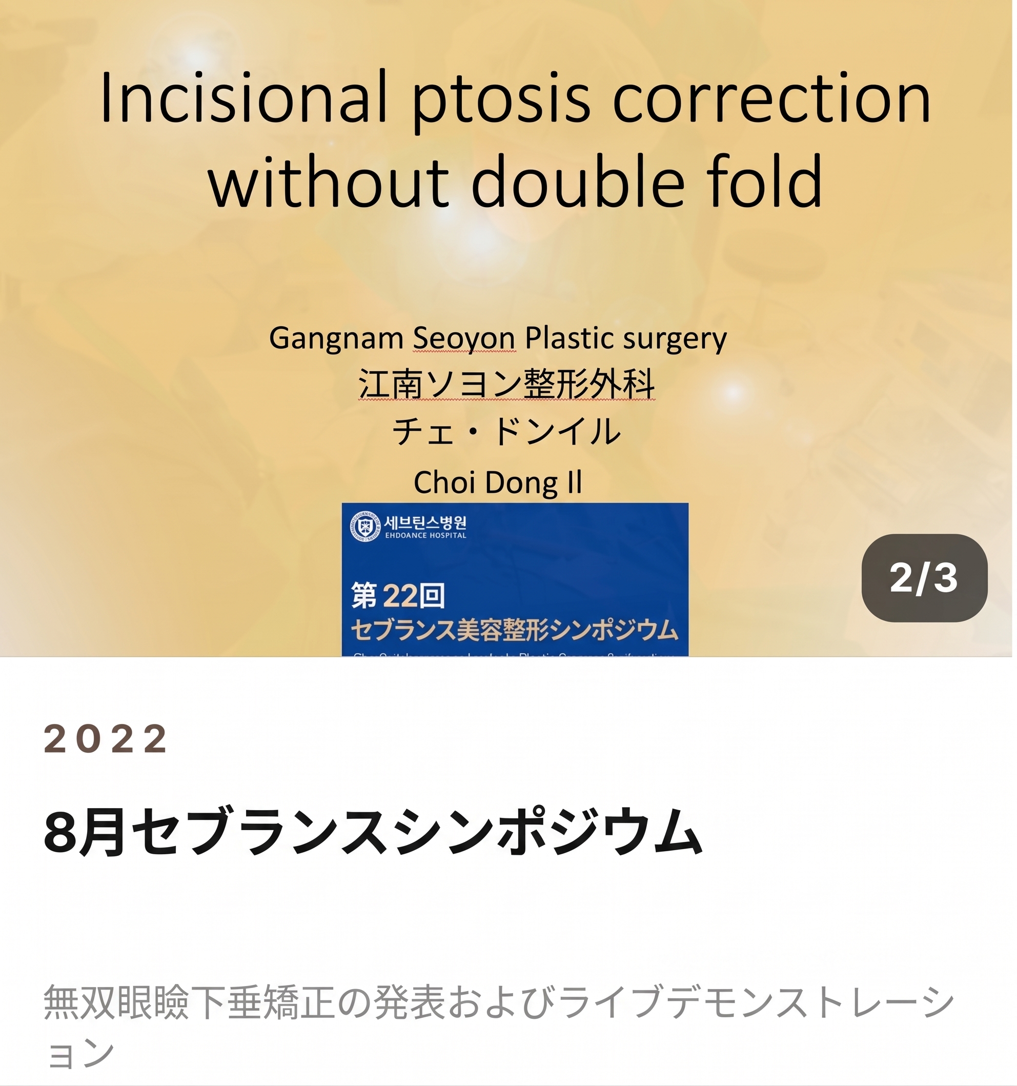 男性の二重幅狭小手術、世界初SCI論文が裏付ける理由 사진 5