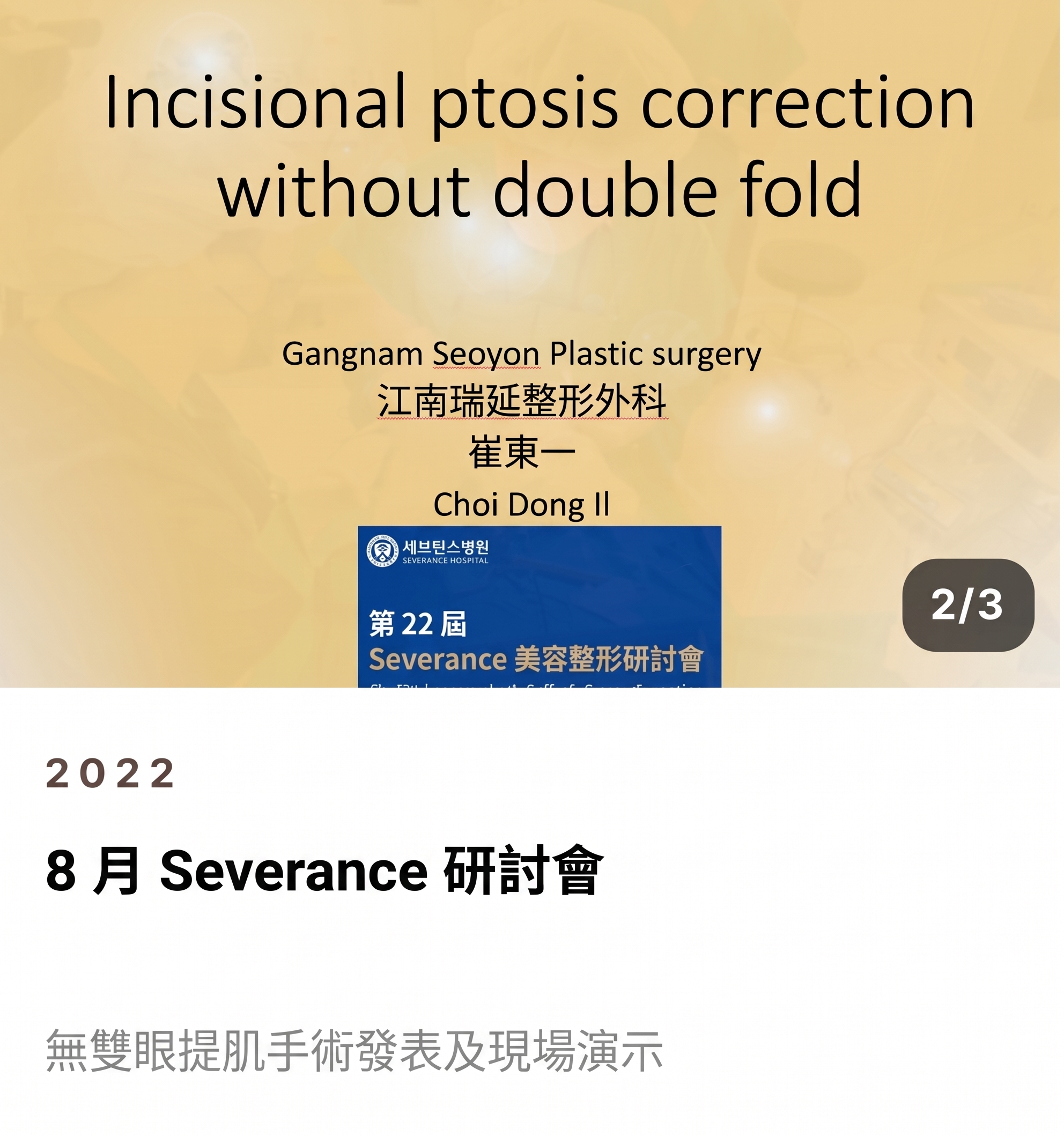 男性雙眼皮降窄手術，由全球首篇SCI國際論文佐證的專業實力 사진 5
