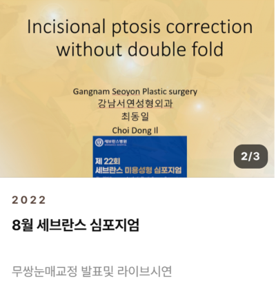 남자 쌍꺼풀 낮추기, 세계 최초 SCI 논문이 뒷받침하는 이유 사진 5