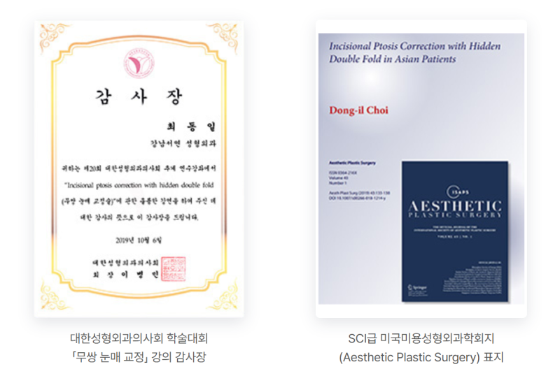 남자 쌍꺼풀 없애기, 살로 덮는 게 핵심입니다