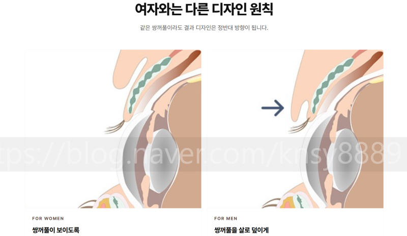 남자 무쌍눈매교정과 라인 낮추기, 한 번에 정리합니다