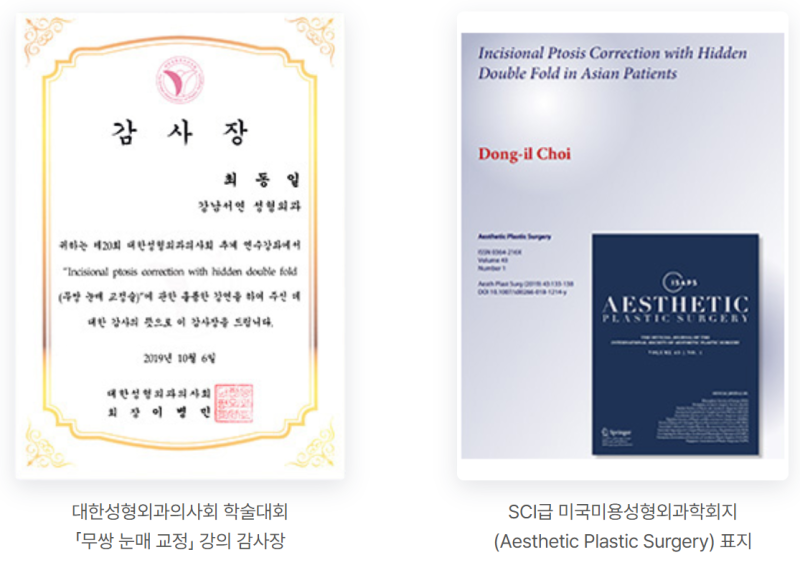 남자 무쌍눈매교정과 라인 낮추기, 한 번에 정리합니다 사진 8